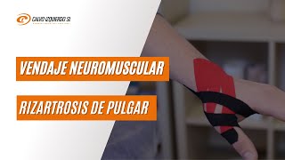 Vendaje neuromuscular para la rizartrosis de pulgar [upl. by Htaras]