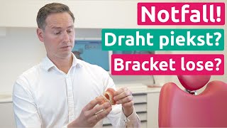 Notfall Draht von der festen Zahnspange piekst Bracket ist lose KFO1  Praxis Dr Schmidt [upl. by Grof307]