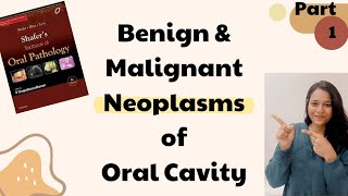 Benign and Malignant Tumors of Oral Cavity  Oral Pathology  Part 1 [upl. by Cimah]