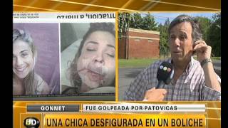 Una chica desfigurada por patovicas en un boliche  Telefe Noticias [upl. by Zoller184]