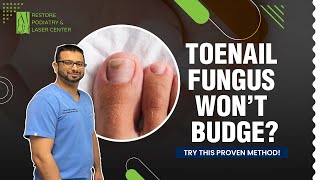 Best Treatment for Toenail Fungus Over 5 Years PodiatristNY ToenailFungus ProvenTreatment [upl. by Kore]