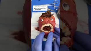 Emergency Surgery How to Prep with Blood Behind The Scenes of the Discount Dentist FruitSurgery [upl. by Tnirb743]