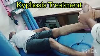 kyphosis Treatment  Chiropractor Treatment  DrRavi kumar  7678369727 [upl. by Foulk957]