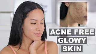 HOW I KEEP MY SKIN CLEAR amp ACNE FREE  Marie Jay [upl. by Gristede]