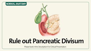 Linear EUS Rule out Pancreatic Divisum [upl. by Reine231]