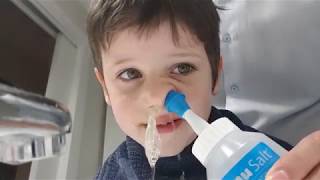 Cómo limpiar la sinusitis a un niño [upl. by Prissy]