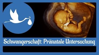 Schwangerschaft Pränatale Untersuchung [upl. by Alyal]