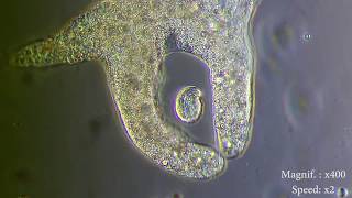 Amoeba eats paramecia  Amoebas lunch   Amoeba Endocytosis  Phagocytosis Part 1  👌 [upl. by Norford149]