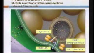 Spasticity Management [upl. by Laureen]