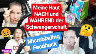 Beauty Autolabervlog Akne Pickel Pickelmale Pigmentflecken l Micoblading Feedback l Vlog 863 [upl. by Philips]