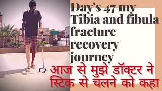 47 days my tibia and fibula fracture journey with stick 1st day OnlyOneEarth [upl. by Hellene]