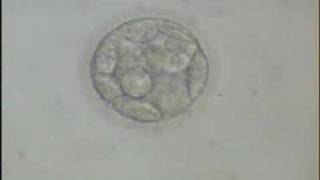 Early Blastocyst [upl. by Anomahs]