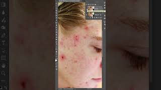 Blemish Removal and Frequency Separation AMAZING photoshop highendskinretouching photoediting [upl. by Hillie790]