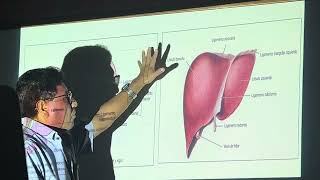 2do GASTROENTEROLOGIA cirrosis hepatica part1 240524 [upl. by Balcer30]