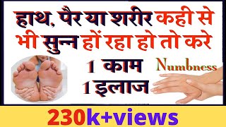 Numbness in Hands and Feet in hindi Reason Treatment  हाथ पैरों का सुन्न होना [upl. by Weylin528]