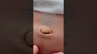 Umbilical granuloma umbilicalcord granuloma newborn baby firsttimemom firsttimeparents [upl. by Osher]