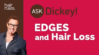 Edges and Hair Loss PostPregnancy or Menopause [upl. by Nnagem]