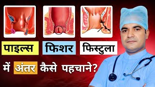 piles fissure fistula mein kya antar hai  piles fissure fistula  piles fissure fistula difference [upl. by Briny757]