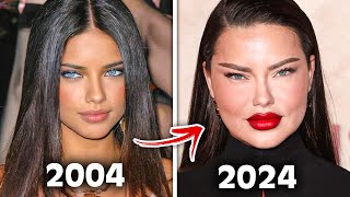 Top 10 Botched Plastic Surgery That DESTROYED Celebrities Careers [upl. by Nylissej]