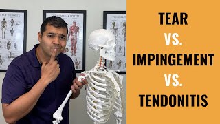 Rotator Cuff Tear VS Shoulder Impingement VS Shoulder Tendonitis [upl. by Glennis395]