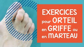 Orteil en griffe ou en marteau infos conseils et exercices efficaces déformations aux pieds [upl. by Nirag918]