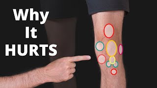 Why Your Knee Hurts Knee Pain Types by Location Chart  Symptoms [upl. by Kammerer]