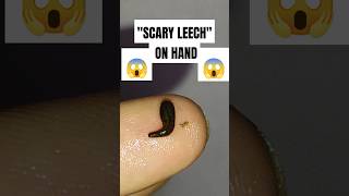 Scary Leech on hand shorts leech insects worms scaryanimal [upl. by Rebmyt]