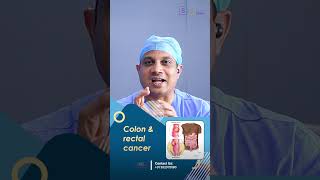 How Is Colon Cancer Treated  Insights from Dr Nilesh chordiya SSO [upl. by Gershom662]