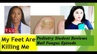 Podiatry Student reviews Brandon Never Washes His Feet  My Feet Are Killing Me nailfungus [upl. by Enyawed991]