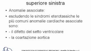 Persistenza della vena cava superiore sinistra [upl. by Anayit544]