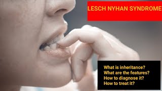 Lesch Nyhan Syndrome  Features Diagnosis Treatment Inheritance [upl. by Nyletac]