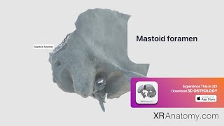 Temporal Bone  Mastoid foramen [upl. by Lesig]