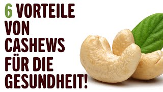 6 VORTEILE VON CASHEWS FÜR DIE GESUNDHEIT  Vorteile von  Tipps für ein Gesundes [upl. by Enneirb210]