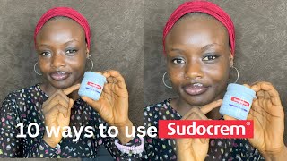 10 WAYS TO USE SUDOCREM Heal Eczema  Acne in 3days [upl. by Okiruy]