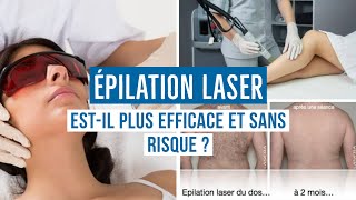 ÉPILATION LASER  TOUT CE QUE VOUS DEVEZ SAVOIR [upl. by Ashla]