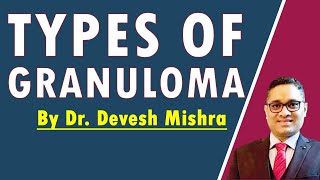 Types of Granuloma by Dr Devesh Mishra [upl. by Rosmunda760]