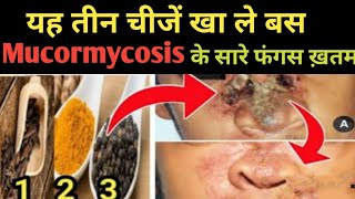 Mucormycosis Symptoms Treatment After Covid  Black Fungus Disease Infection [upl. by Valli105]