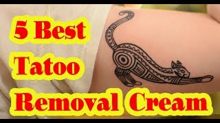 Best Tattoo Removal Cream to buy in 2020 [upl. by Lejna889]