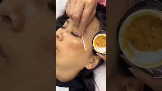 dark spots on face removal shorts skin beautytips [upl. by Teragramyram]