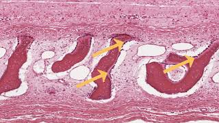 Intramembranous Ossification [upl. by Ajidahk77]