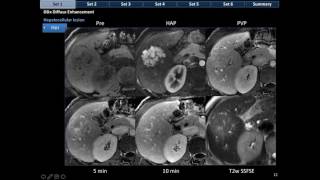 5 CT and MRI Algorithm [upl. by Burra738]