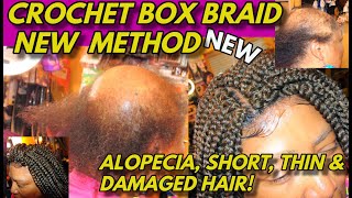 NEW CROCHET BOX BRAIDS DETAILED METHOD FOR ALOPECIA HAIR LOSS THIN amp DAMAGED HAIR [upl. by Logan]