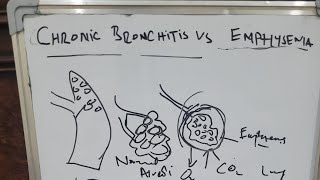 Bronchitis VS Emphysema complete lecture with explanation 😊😇 [upl. by Akimaj]