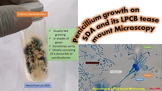 Penicillium growth on SDA and its LPCB tease mount Microscopy [upl. by Boykins]