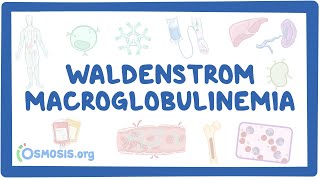 NORD  Waldenstrom Macroglobulinemia [upl. by Marzi434]