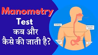 Manometry test कब और कैसे की जाती है   What is Manometry Test  Dr Zubin Dev Sharma  Hindi [upl. by Morse]