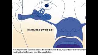 Oorontsteking  Oorzaak en behandeling oorpijn [upl. by Elleral]