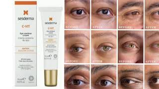 Sesderma CVIT Eye Contour Cream [upl. by Arama609]