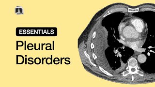 Pleural Disorders  Chest Radiology Essentials [upl. by Sila]