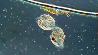 Lamour Or Cell Division in the Ciliated Protozoa Oxytricha 500X [upl. by Venola61]